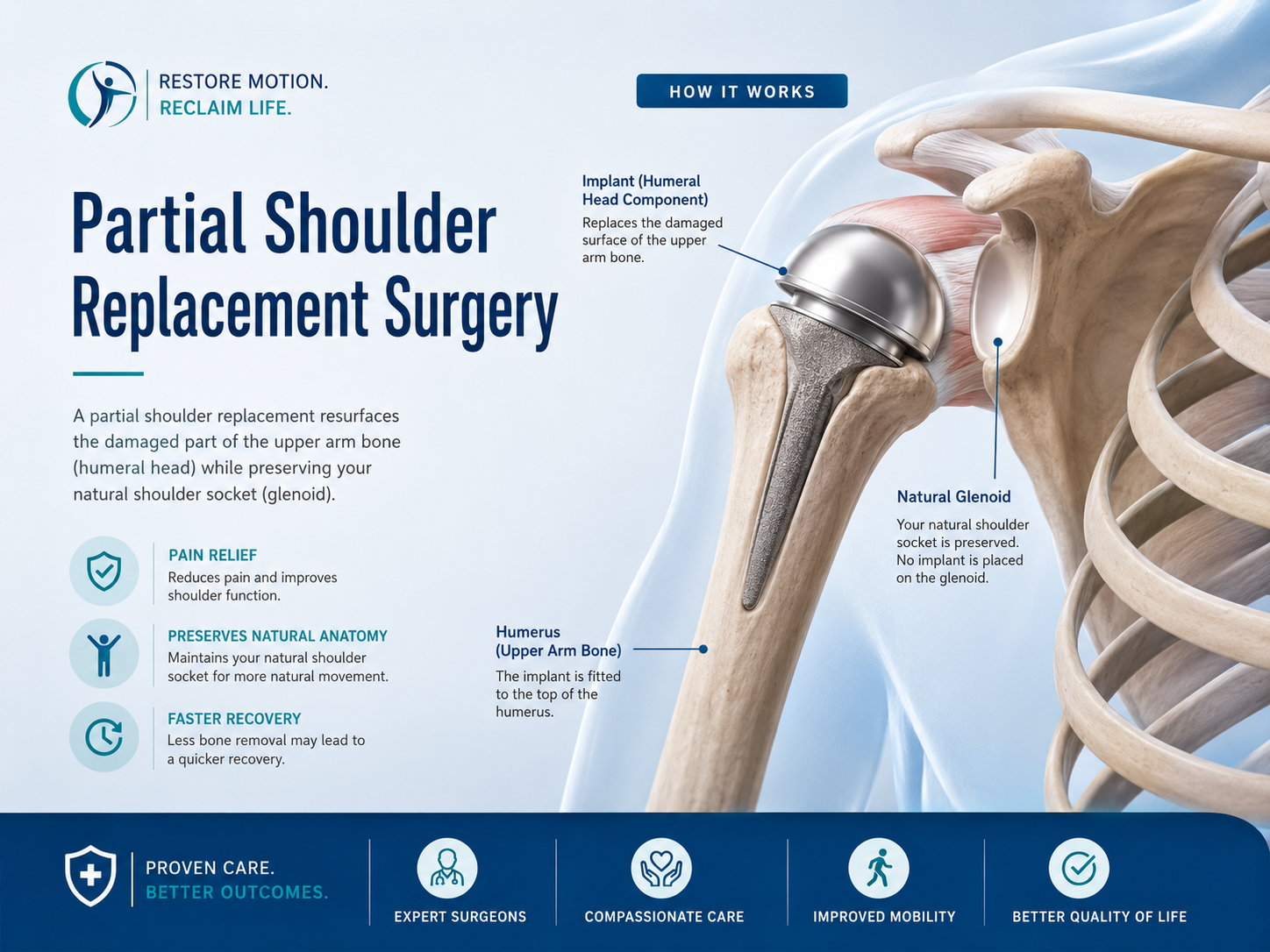 Partial shoulder replacement surgery in Bangalore